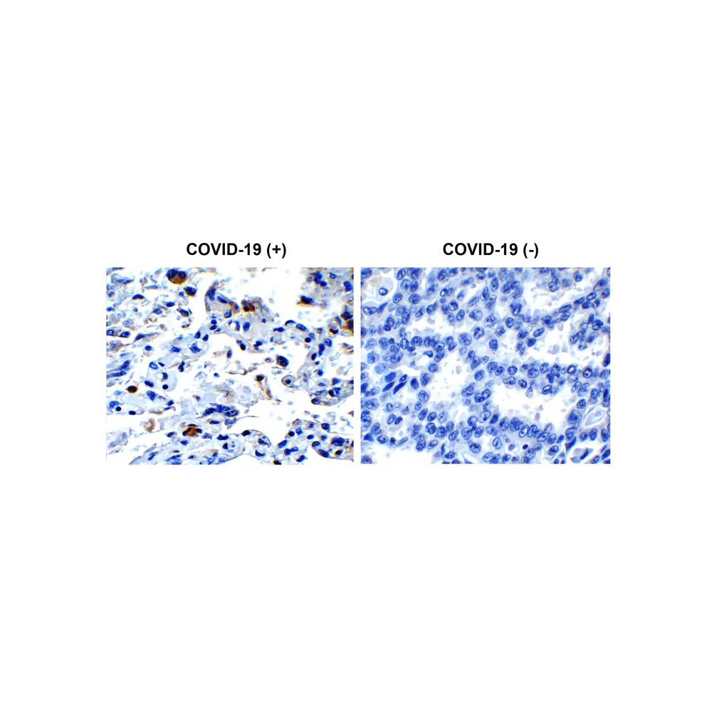 ProSci 9169 SARS-CoV-2 (COVID-19) Envelope Antibody, ProSci, 0.1 mg/Unit Primary Image